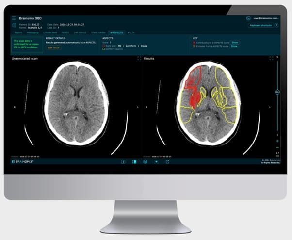 AI-Powered Medical Imaging & Diagnostic Tool